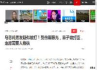 马思纯男友疑似被打！受伤照曝光，鼻子被打歪，走路需要人搀扶|大张伟|娱乐圈|谈恋爱|新恋情_网易订阅